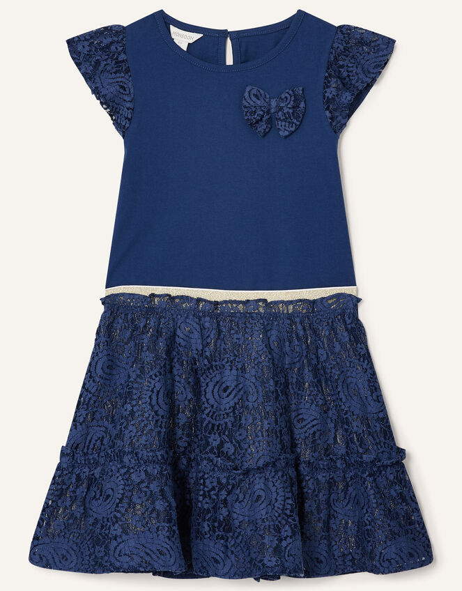 Lace Top and Skirt Set, Blue (NAVY), large